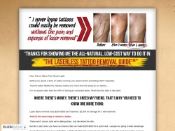 Laserless Tattoo Removal Guide Reviews